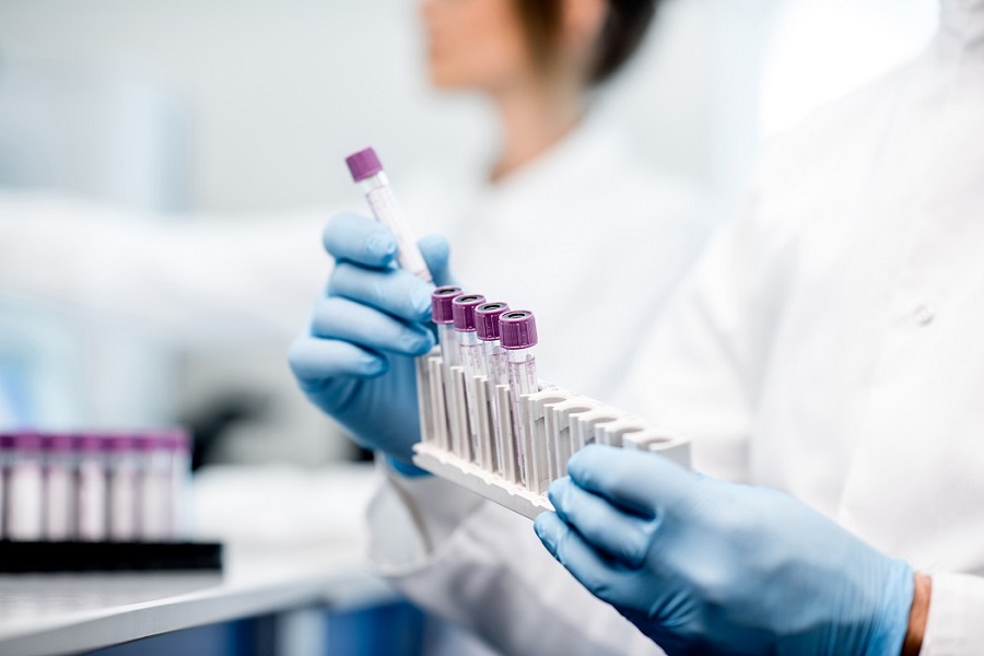 Delle provette di laboratorio